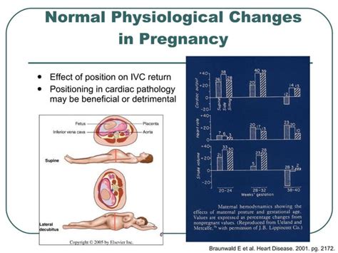 Approach To Cardiac Diseases In Pregnancy