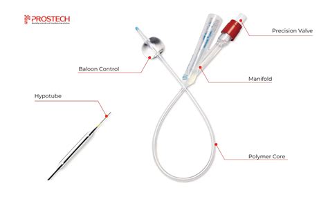 Catheter Assembly Choosing The Right Medical Adhesive Grade Prostech