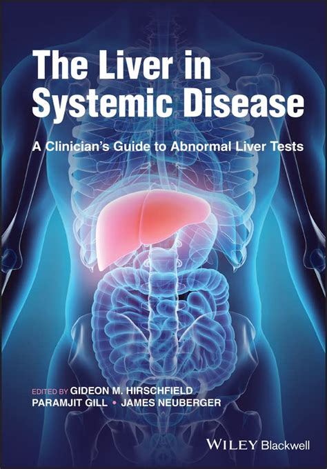 The Liver In Systemic Disease A Clinician S Guide To Abnormal Liver Tests Ebook Hirschfield