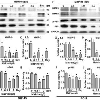 Matrine reduces the levels of MMP 2 and MMP 9 via NF κB signaling