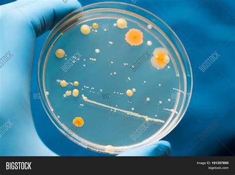 A Petri Dish With Growing Cultures Of Microorganisms Fungi And