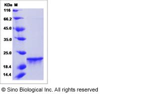 Recombinant Human Fgf Protein Hnae Sino Biological