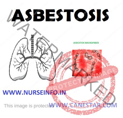 Asbestosis Nurse Info