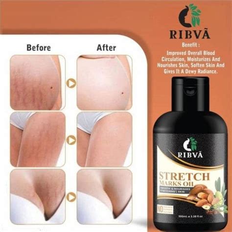 Ribva Present Stretch Marks Removal Oil Natural Heal Pregnancy Hip