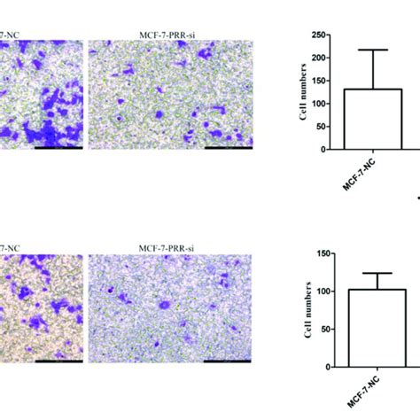 Effect Of ATP6AP2 Knockdown On MCF 7 Cell Invasion And Migration A