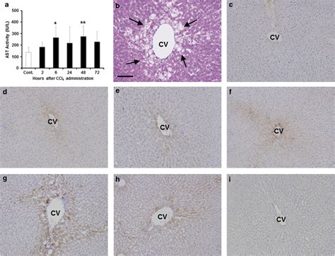 Oxidative Liver Injury Following Carbon Tetrachloride Ccl4