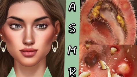 Asmr Ear Cleaning Animation Youtube