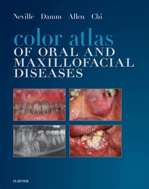 Color Atlas Of Oral And Maxillofacial Diseases Color Atlas Of Oral And