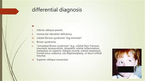 Brown Syndrome Ppt