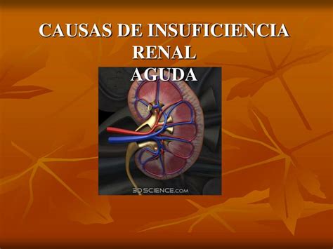 Causas De Insuficiencia Renal Aguda DENNIS JAVIER SOTELO UDocz