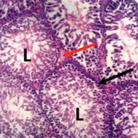 Photomicrograph Of The Testes Of A Control Rat Showing Normal Testes Download Scientific