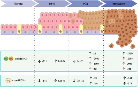 Mirnas Involved In Prostate Cancer Clinical Outcome The Most Described