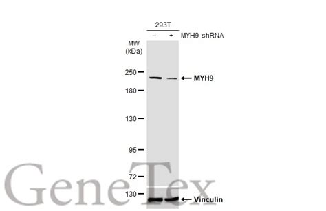 MYH9抗体 N1 2 N term GTX113236 GeneTex中国官方网站