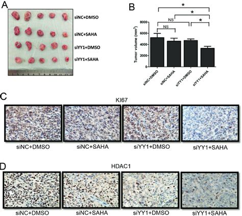 Effects Of Yy1 On The Sensitivity Of Hcc Cells To Hdaci In Vivo A