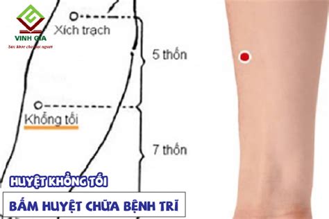 Cách Bấm Huyệt Chữa Bệnh Trĩ Cho Hiệu Quả Tốt Nhất