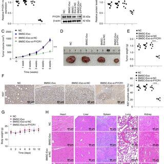 Exo Si PYCR1 Prevents BC Xenograft Tumor Growth In Nude Mice And