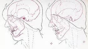 Visible Proofs Forensic Views Of The Body Galleries Cases The Buck