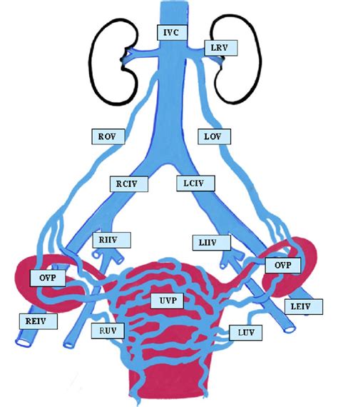 Normal pelvic and ovarian venous anatomy. The rich uterine venous ...