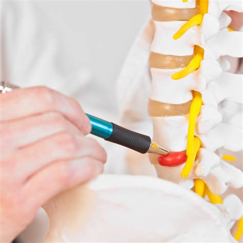 How Chiropractic Helps Heal A Bulging Disc Integra Healthcare