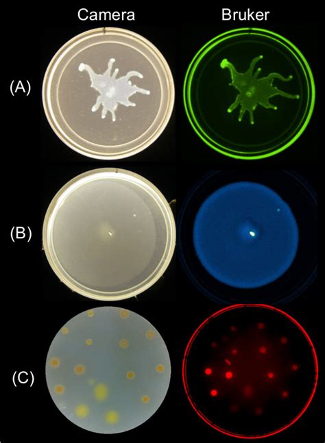 Preparation Imaging And Quantification Of Bacterial Surface Motility