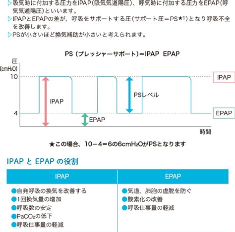 非侵襲的陽圧換気（nppv）とは？ 看護roo [カンゴルー]