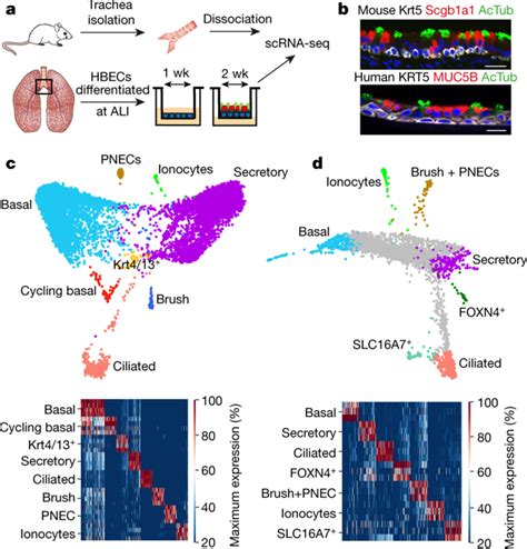 Discover The Cftr Rich Pulmonary Ionocyte In The Airway Epithelium