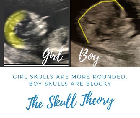 The Skull Theory The Physical Attributes Of Your Baby S Skull Matter