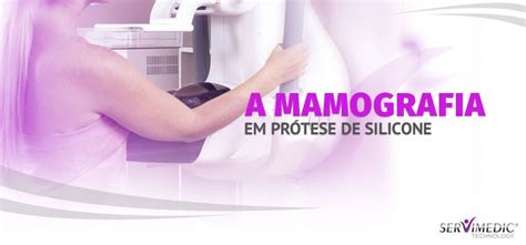 A Mamografia Em Pr Teses De Silicone Servimedic Technology