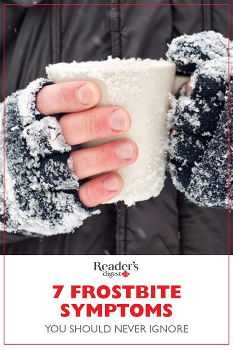 7 Frostbite Symptoms You Should Never Ignore | Frostbite symptoms, Frostbite, Symptoms