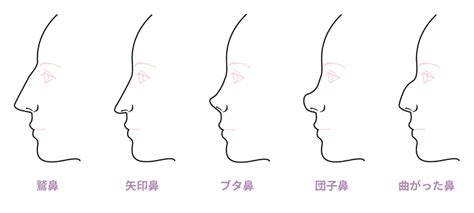 高さも、かたちも、思いのまま憧れの美鼻を私らしく！ドリーム整形外科の鼻整形 韓国美容整形navi