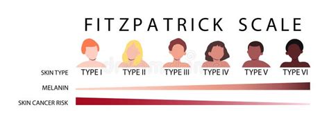 Fitzpatrick Skin Scale Stock Illustrations – 16 Fitzpatrick Skin Scale ...