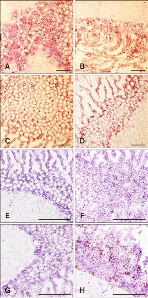 Images From The Immunohistochemical Analysis Of CD3 T Cells And