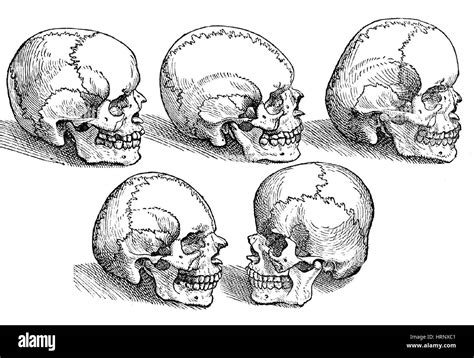 Deformed skulls hi-res stock photography and images - Alamy