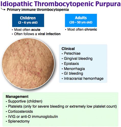 Idiopathic Thrombocytopenic Purpura Pathophysiology