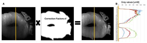 Illumination Correction Of Spim Images A Schematic Representing The