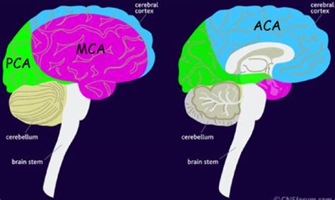 Cerebrovascular Diseases Infections Flashcards Quizlet