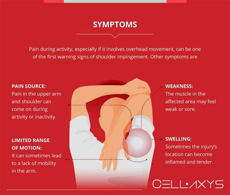 Periacetabular osteotomy pao surgery how to boost recovery time – Artofit