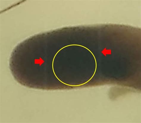 Sem To Tem Technique For Higher Resolution Imaging Cambridge