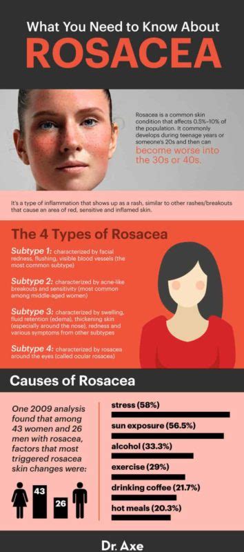 Rosacea Treatment 6 Natural Remedies To Use Dr Axe