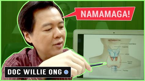 Goiter Bukol Sa Leeg Ni Dr Willie Ong 111b Youtube