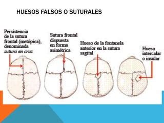 Anatom A Huesos Wormianos Ppt