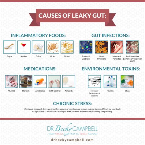 Histamine Intolerance And Your Gut Dr Becky Campbell