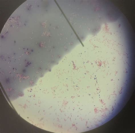 Micro Lab Gram Staining Flashcards Quizlet