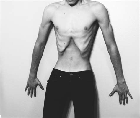 Male Anorexia Tumblr