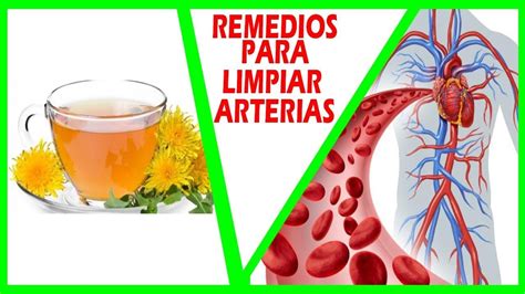 4 Infusiones Herbales Para Limpiar Las Arterias Naturalmente En 2020