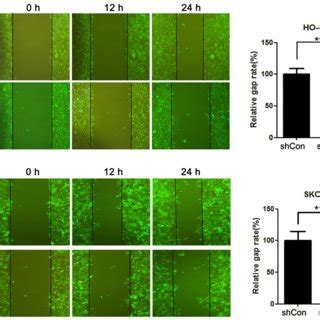 Usp Promotes Progression Of Ovarian Cancer Cells Via Blocking P P