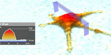 Wound Healing Assay Single Cell Migration Holomonitor