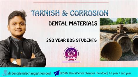 Tarnish And Corrosion Dental Materials Bds Nd Year Students