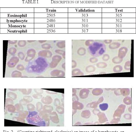 Table I From A Comparative Analysis For Leukocyte Classification Based