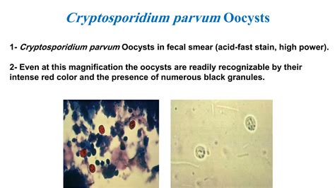 Parasitology Intestinal Protozoa Ppt